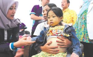 Finza, Enlarged Stomach Boy Referred to Blambangan Hospital