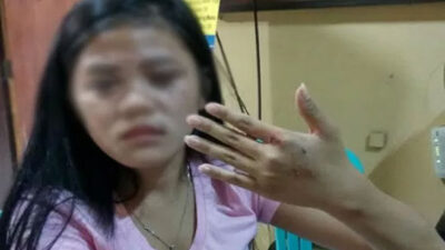 Beaten by the Boyfriend, This young girl reported to the police