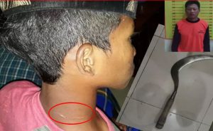 Injak Tanaman Saat Kejar Layangan Putus, Bocah di Banyuwangi Nyaris Dibacok Petani