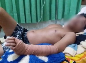 Pemuda Asal Purwoharjo Diduga Jadi Korban Pengeroyokan di Tempat Karaoke