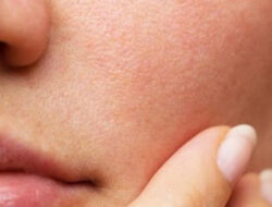 6 How to Shrink Too Large Facial Pores Naturally
