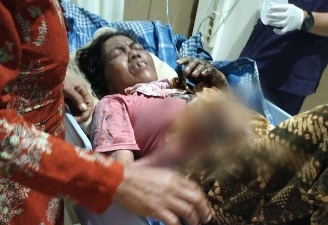 tersambar-api-saat-rumah-kebakaran,-seorang-nenek-di-banyuwangi-jalani-perawatan-intensif