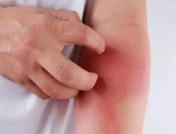 Waspada, Makanan Sehat Ini Diam-diam Bisa Memicu Peradangan – TIMES Banyuwangi