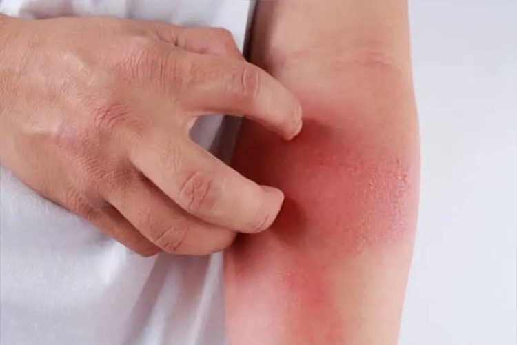 waspada,-makanan-sehat-ini-diam-diam-bisa-memicu-peradangan-–-times-banyuwangi