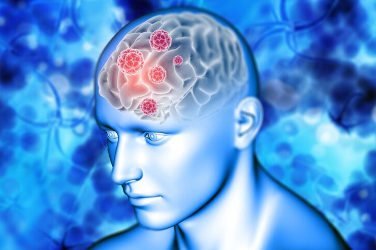 tips-menjaga-kesehatan-mental-dan-menghindari-brain-rot-–-times-banyuwangi