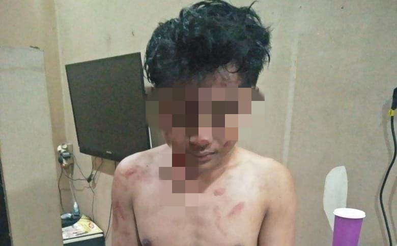 satu-dari-tiga-terduga-pelaku-pembacokan-di-cungking-banyuwangi-diamankan-polisi
