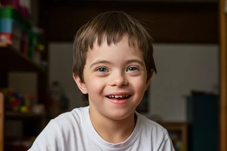 bukan-karena-saudara!-ini-alasan-medis-wajah-penyandang-down-syndrome-sering-mirip