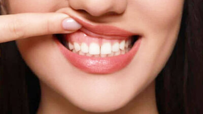 mengapa-fluoride-penting-untuk-kesehatan-gigi?-–-times-banyuwangi