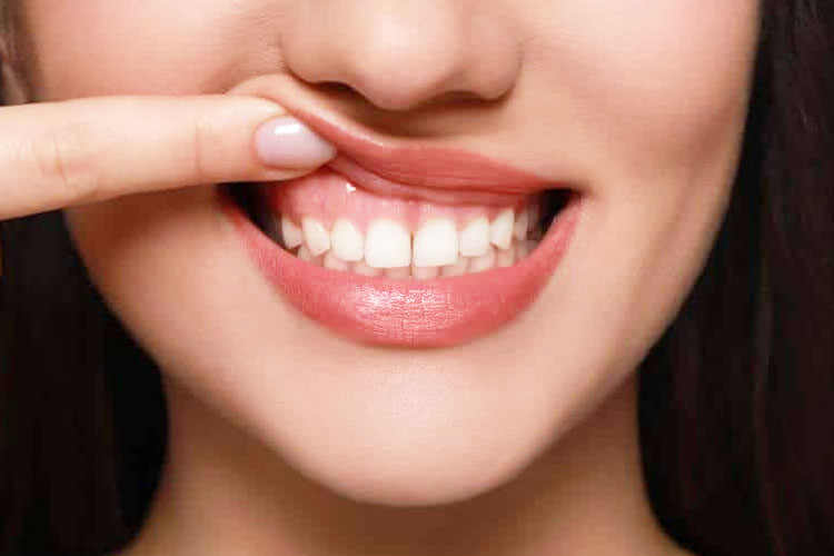 mengapa-fluoride-penting-untuk-kesehatan-gigi?-–-times-banyuwangi