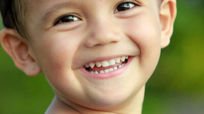 gigi-susu-bukan-“sementara”-dan-mengapa-harus-dirawat-sejak-dini-–-times-banyuwangi