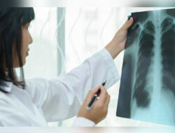 Indonesia Tambah Anggaran Khusus untuk Percepatan Deteksi TBC – TIMES Banyuwangi