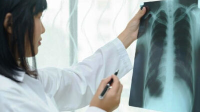 indonesia-tambah-anggaran-khusus-untuk-percepatan-deteksi-tbc-–-times-banyuwangi