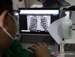 Batuk Tak Kunjung Sembuh, Dokter Ungkap Tanda Awal TBC pada Anak dan Dewasa – TIMES Banyuwangi