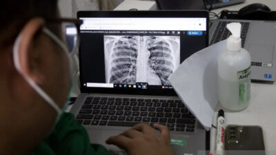 batuk-tak-kunjung-sembuh,-dokter-ungkap-tanda-awal-tbc-pada-anak-dan-dewasa-–-times-banyuwangi