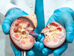 Mengenal TB Ginjal yang Diidap Lucky Element, Penyebab dan Pengobatannya – TIMES Banyuwangi